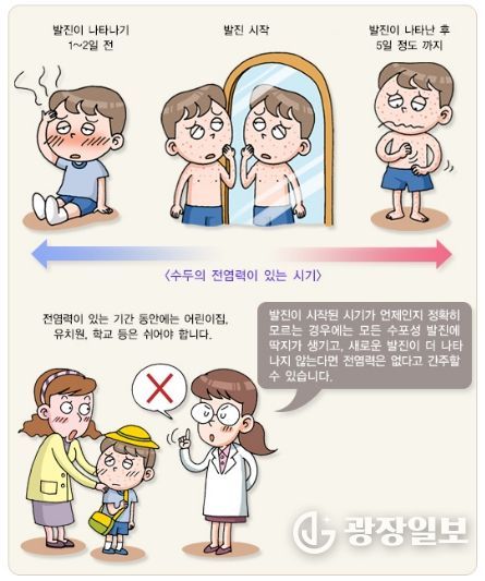 수두 예방 홍보물